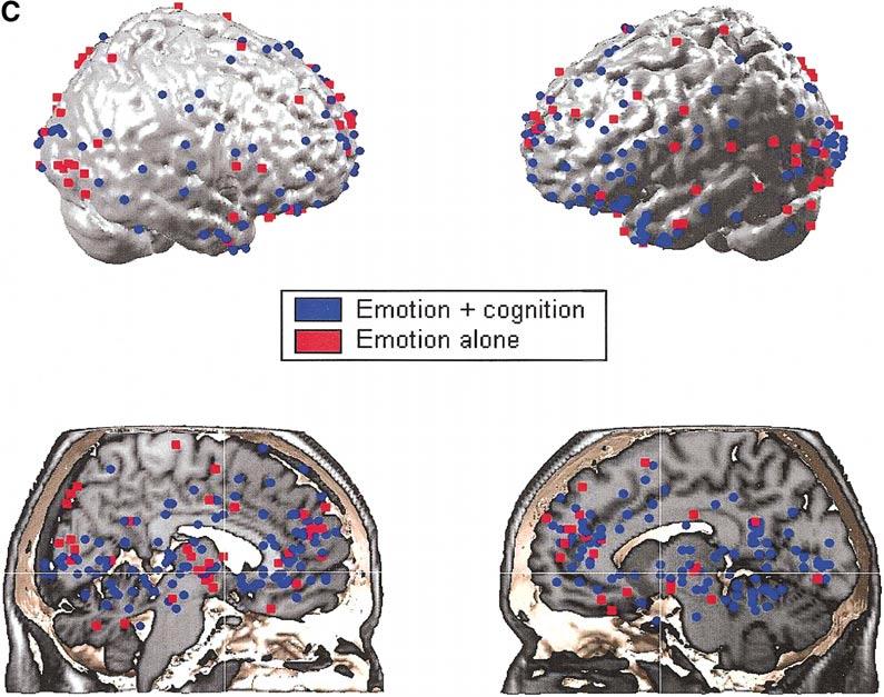 FUNCTIONAL NEUROANATOMY OF EMOTION 335 FIG. 1C. Activation foci: Cognitive demand. tion foci according to Individual Emotion, Induction Method, and Cognitive Demand.