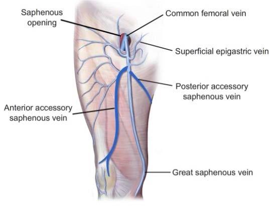 Accessory Veins of GSV Saphenous opening Common femoral vein