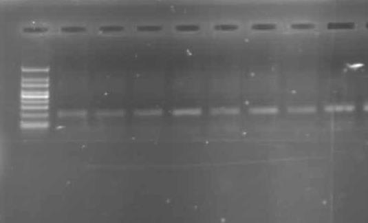 RESULTS The electrophoresis gel view of DNA samples on PCR amplification and restriction digestion was obtained as: L1 L2 L3 L4