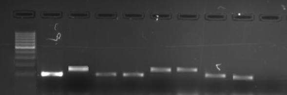agarose gel. Figure 2: PCR Amplified product of gastric cancer DNA samples run on 2% agarose gel.