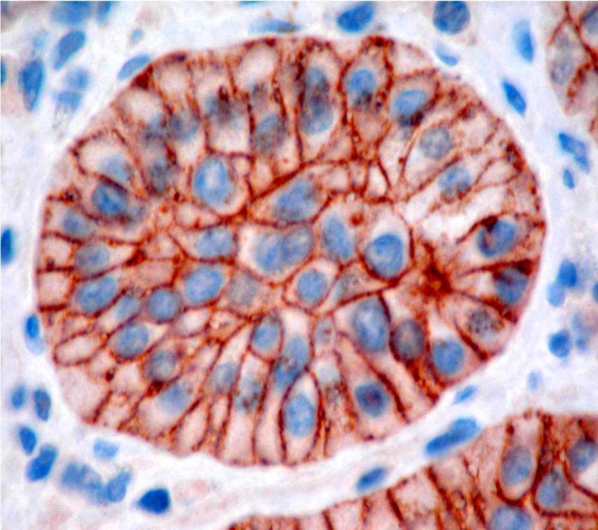 The reason of success: The target Immunohistochemical Detection