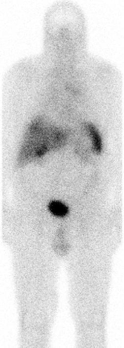 scintigraphy 4 h p.i. PET 1 h p.i. Courtesy of D.