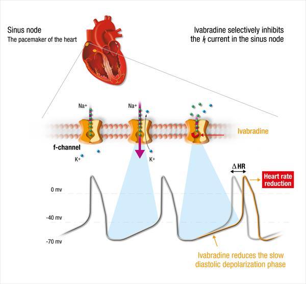Ivabradine (Corlanor) New therapeutic agent Selectively inhibits the If current in the SA node causing heart rate reduction Funny