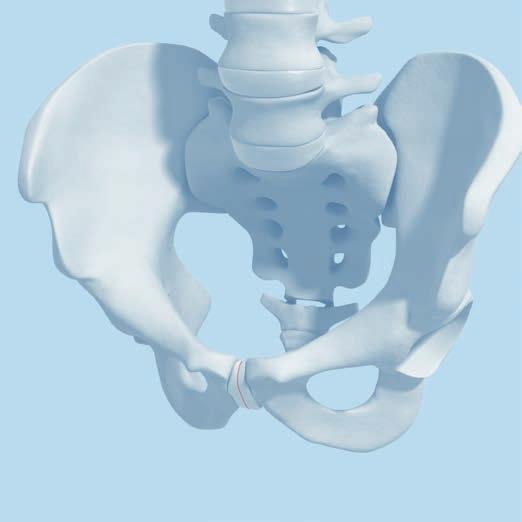 Fracture Fixation Note: The following cases of fracture fixation represent possible uses of pelvic instruments.