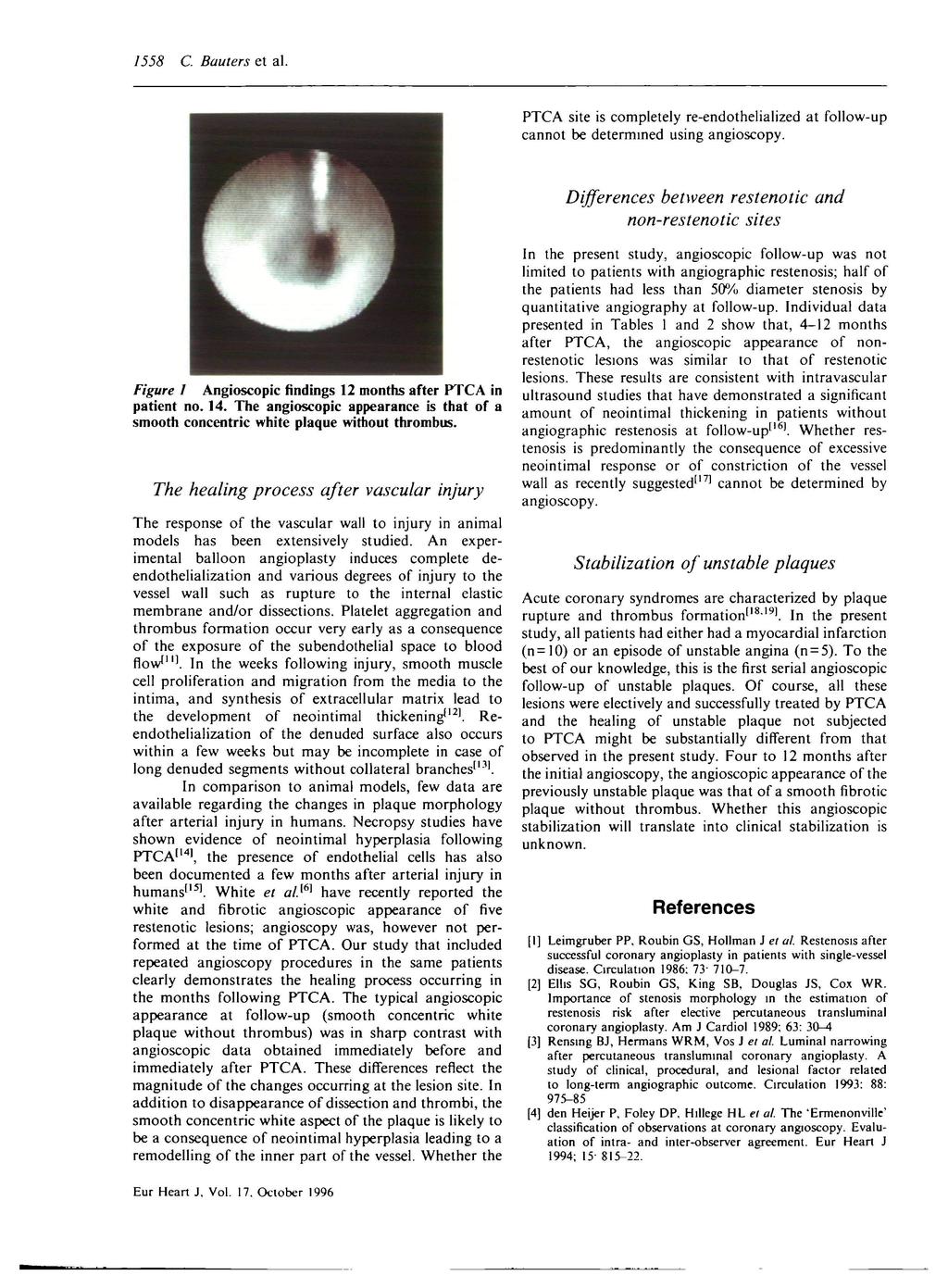 1558 C. Bauters et al. PTCA site is completely re-endothelialized at follow-up cannot be determined using angioscopy.