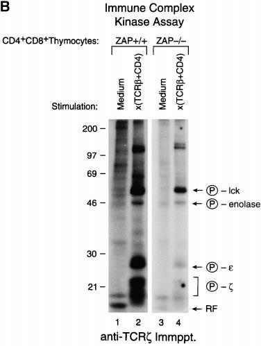 ZAP-70 protein expressed in ZAP DP (Fig. 1, bottom row). Interestingly, tyrosine phosphorylation of ITAMs from mutant ST and ZAP mice were also essentially equivalent (Fig.