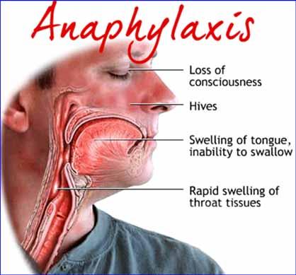 Anaphylaxis Type I hypersensitivity Skin ( urticarial and/or angioedema) plus