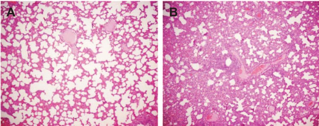 10824 NOTES J. VIROL. FIG. 3. Hematoxylin- and eosin-stained sections of lung from an uninoculated pig (A) and a pig infected with A/Vt/1203/04 virus (B).