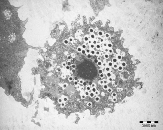 Measles Large RNA virus Cultures