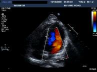 WINFOCUS BASIC ECHO (WBE) Practical Echocardiography and