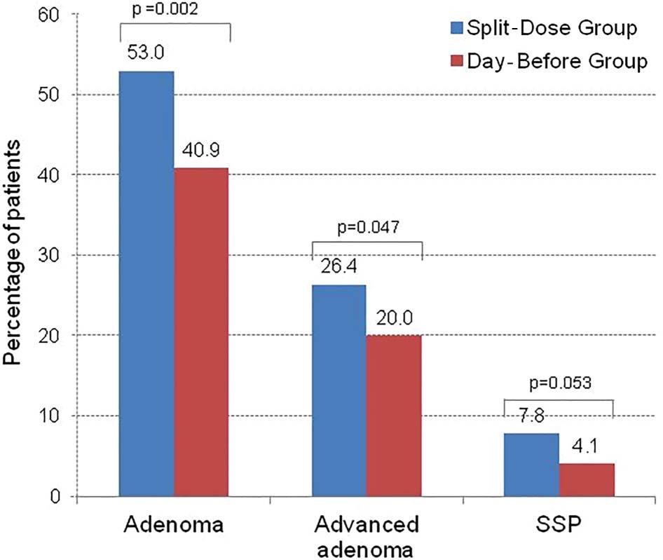 Proportion of subjects with at least one adenoma, advanced adenoma and sessile serrated polyps