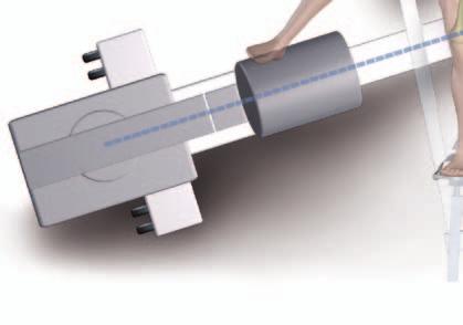 On the fluoroscopic image, the goal is to achieve a projection showing the Drill Sleeve Assembly and the nail to be in line as shown on Fig. 26a.