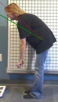 Lumbar Motion Analysis Lumbar Flexion
