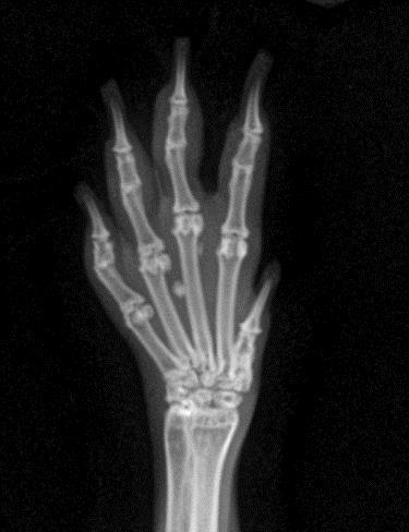 A B Figure 13 : Radiographies de pattes avant droite (A) et gauche (B) de Micah. Elles ne présentent pas de malformations au niveau des os des doigts et du métacarpe.