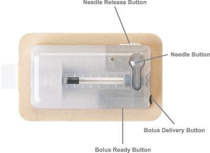 V-GO INSULIN DELIVERY DEVICE Delivers basal insulin in pre-set basal rate Can administer meal bolus in 2 unit