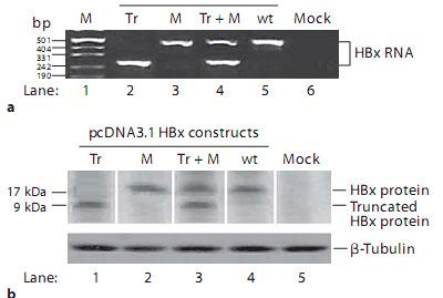 HBx Mutants Dysregulate STAT/SOCS Signaling In HCC patients shown random mutations throughout HBx-gene, and 4/48 HCC patients were