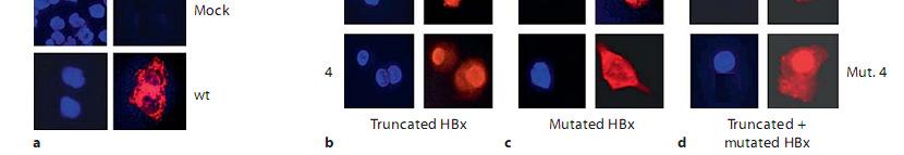 The truncated HBx-protein is mainly distributed in the nuclei, randomly mutated HBx protein had a predominant