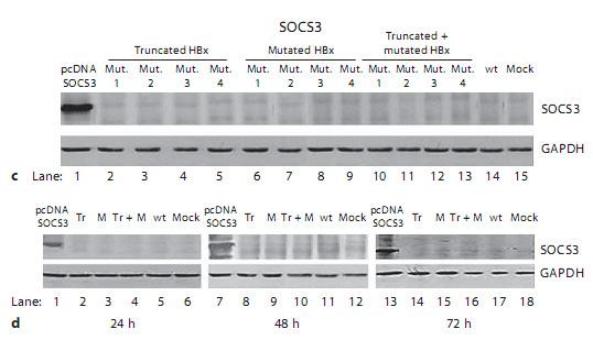and SOCS1 proteins in Wt or mutated