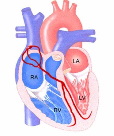 Quick Procedural Overview Electrophysiology services involve the electrical function of the heart.