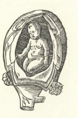 Illustrations Rueff 1554 Guillemeau 1635 Wolveridge 1670 Figure 4.