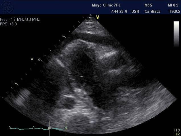 66 year old woman with dyspnea 2016