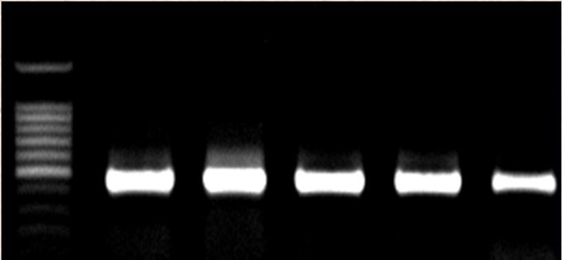 500 bp M 1 2 3 4 5 441 bp β-actin (M: 100 bp marker; 1: