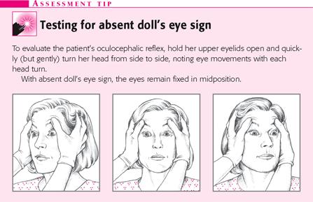 Test brainstem dysfunction Pupillary response Corneal reflex Spontaneous eye movements