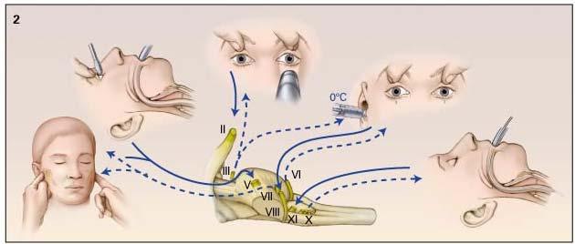 Brain stem reflexes Pupils (II, III) Corneals (V, VII) Pain (V, VII) Gag (IX, X)