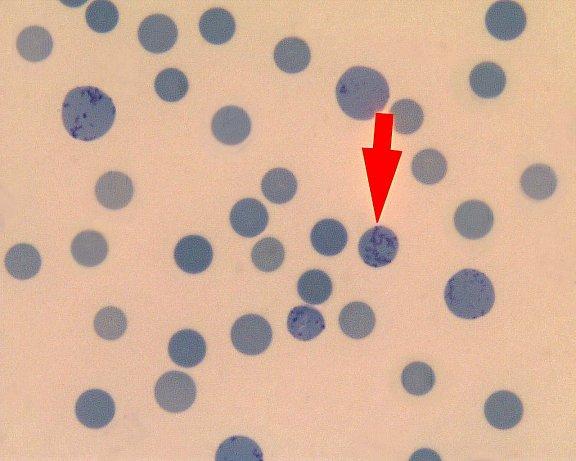 5 days in marrow, 1 day in blood Reticulocytes demonstrated by Crystal