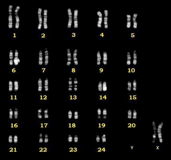6 Buffalo metaphase with abnormal SCEs The RBA-banding chromosomes revealed normal karyotype (2n=50,XY) for 21male and for 20 female
