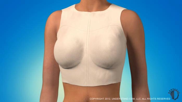 Recovery Most breast augmentation procedures are done in outpatient surgery facilities, meaning you should be ready to go home the same day, usually within two to four hours.