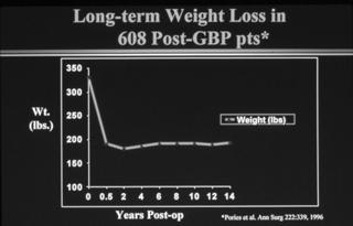 Long Term Results Gastric Bypass Mean Percent Weight Change during a 15-Year Period in the Control Group and the Surgery Mean Percent Weight Change during a 15-Year Period in the Group, According to
