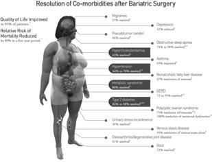 associated with obesity and binge-eating disorder (BED) 300 patients (233 women, 67 men) with a mean BMI of 43.