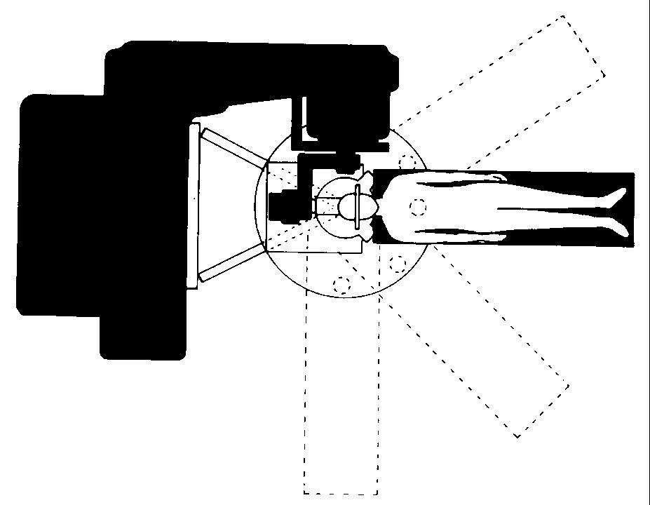 plane Use multiple isocenters: axial plane Irregular shape Use multiple isocenters (for circular cones), or Micro-MLC conformal beam shaping (static beams/arcs or dynamic conformal arc) Circular
