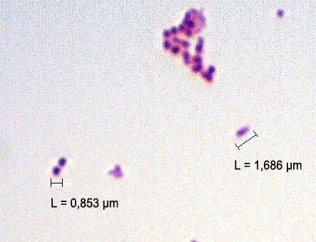 Slika 7. Bakterijske stanice A. junii obojane metodom po Gramu (metoda opisana u Prilogu 1).
