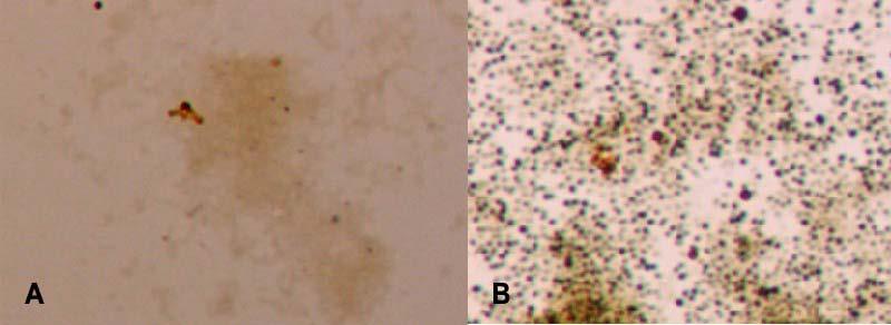 Slika 11. Nedostatak zrnaca poli-p u bakterijama A. junii inkubiranim u vodi bez iona Mg (A) i mnoštvo zrnaca poli-p u bakterijama A. junii inkubiranim u vodi sa suviškom iona Mg (B). 4.