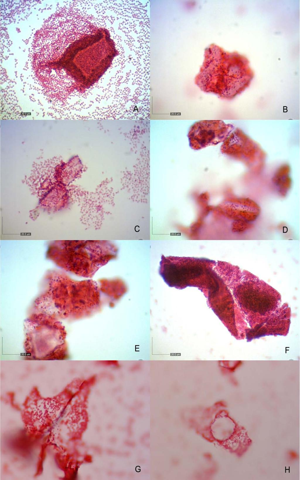 Slika 17. Stanice bakterije A.