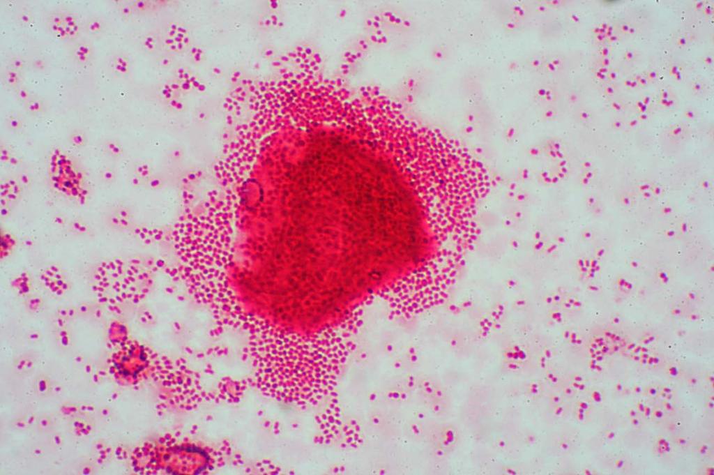 Slika 31. Biočestica čestica nosača s uspostavljenim biofilmom bakterije A. junii.