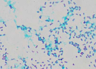 Slika 35. Stanice bakterije A. junii (obojene crveno) povezane u biofilm vanstaničnom tvari (obojeno plavo) vidljive pod svjetlosnim mikroskopom kada se preparat oboji metodom ancijan blue.