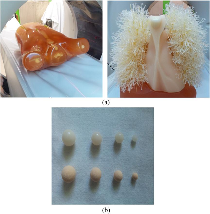 KW Doo et al algorithms offered by different vendors, we used adaptive iterative dose reduction system using a three-dimensional processing algorithm (AIDR 3D; Toshiba Medical Systems, Otawara,