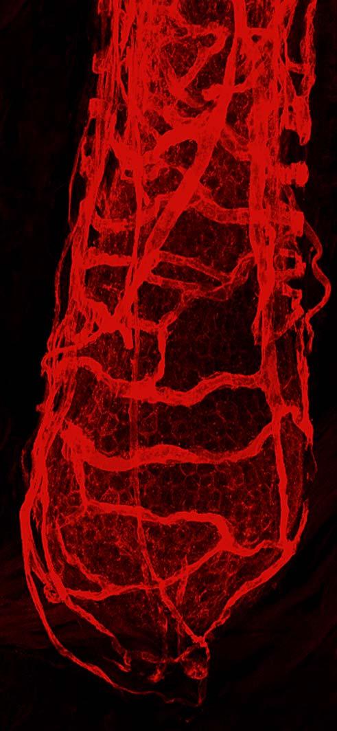 UEA1-FITC Staining of Perivascular Network