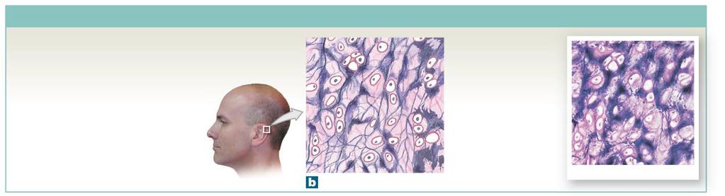 Figure 4-11b Types of Cartilage.