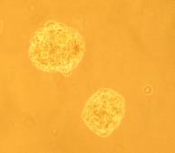 Glioblastoma stem cells induce tumors
