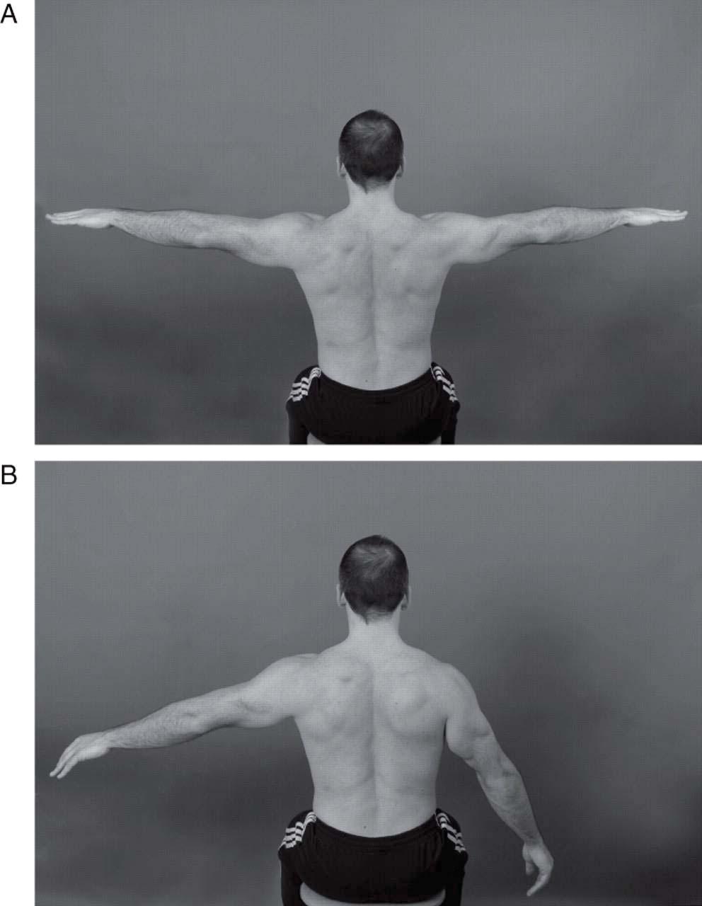 Evaluation of shoulder pain