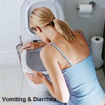 Diarrhoea and Vomiting Diarrhoea alone has to be