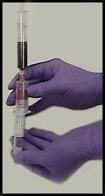 Transfer device placed on a syringe Evacuated tube placed on needle inside transfer device Photographs courtesy of Ann Gray, Inpatient Phlebotomy Supervisor, Physicians Reference Lab, Kansas City,