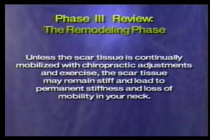 to 12 months to complete healing process. Scar tissue initially forms to help muscles withstand stress but can continue to contract up to six months following an injury.