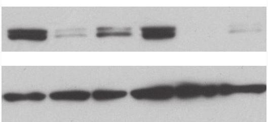 P-S6K S6K Atg7 2h 8h 2h 8h NS Atg7 S12. NRK cells were transfected with non-specific RNAi (NS) or RNAi against atg7(atg 7).