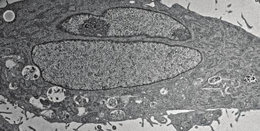 Upper panel shows enlargement of a tubule beginning to vesiculate (a).