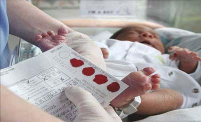 Residual Blood Spots from Newborn